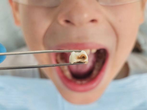 Best Emergency Dentist Near Me  in New Cordell, OK