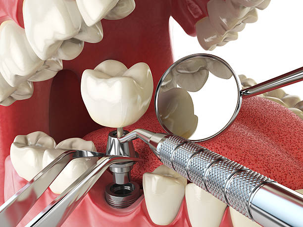 Best Broken Tooth Emergency  in New Cordell, OK